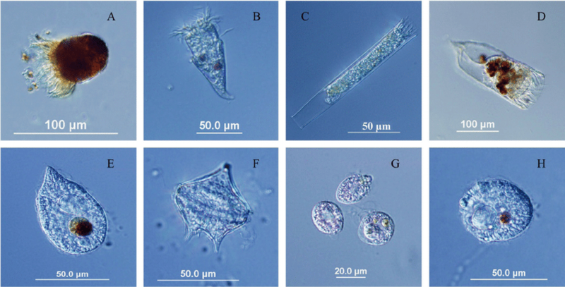 Soil Biology - Protozoa 